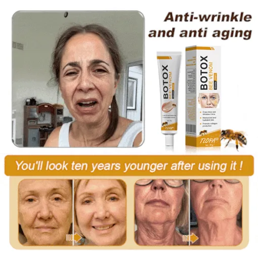 𝗧𝗟𝗢𝗣𝗔® Botox Bee Venom Wrinkle Removal Cream