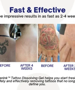 VanInk™ Tattoo Dissolving Gel